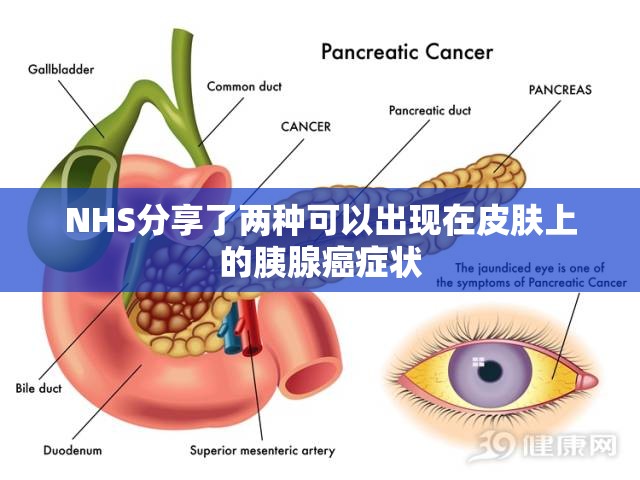 国际 第28页